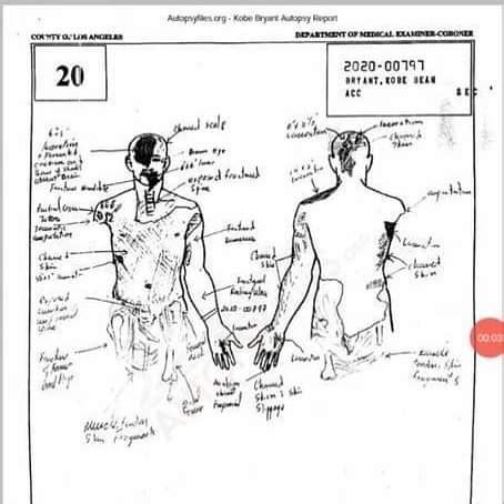 gigi bryants autopsy report|Gigi Autopsy Report: PDF, In